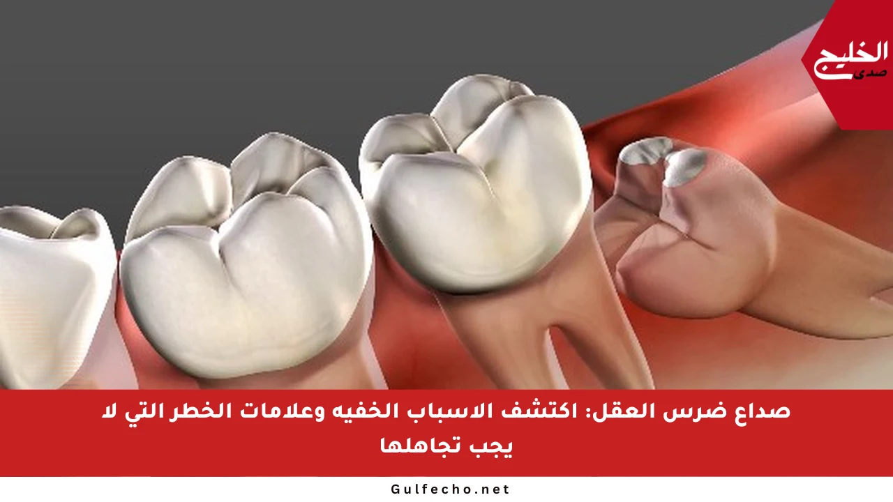 صداع ضرس العقل: اكتشف الأسباب الخفية وعلامات الخطر التي لا يجب تجاهلها